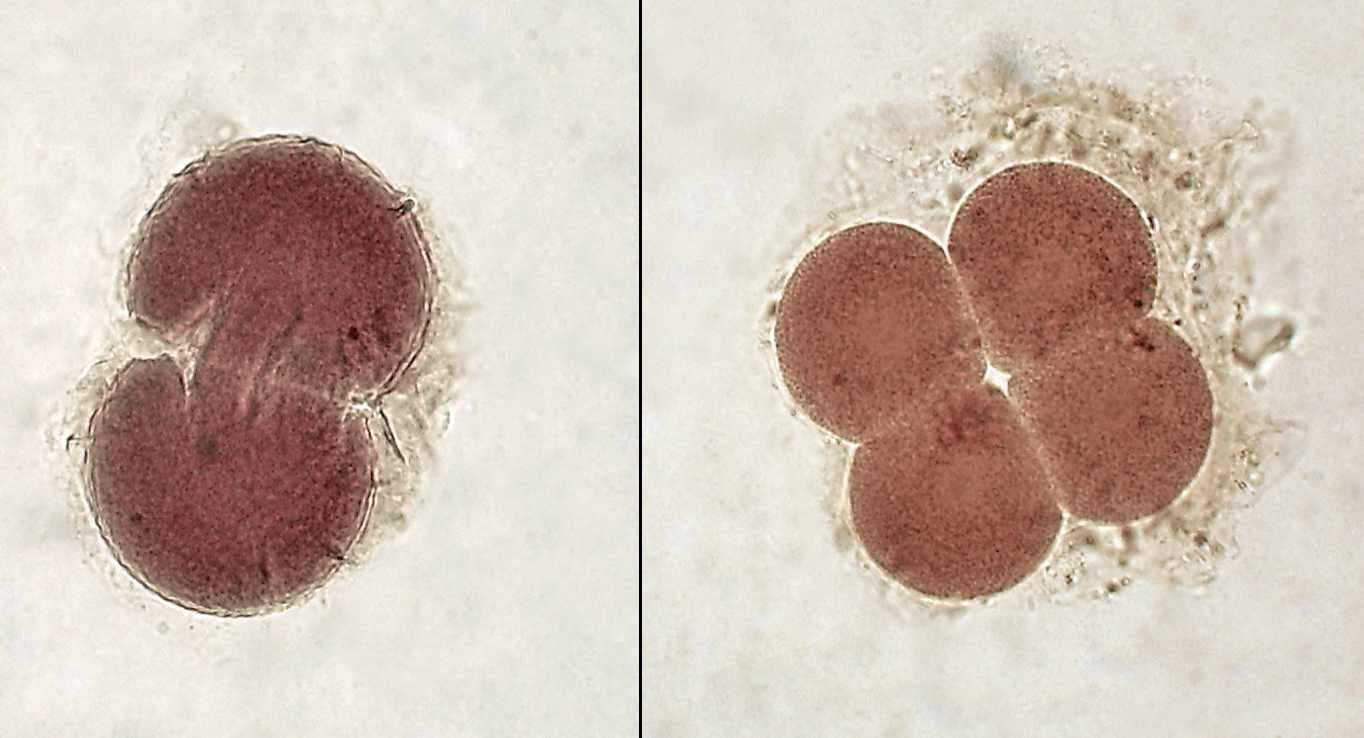 Human embryos